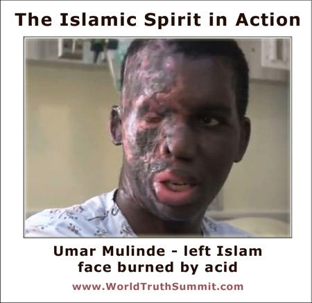Islamic Spirit - Umar Mulinde - face burned by acid